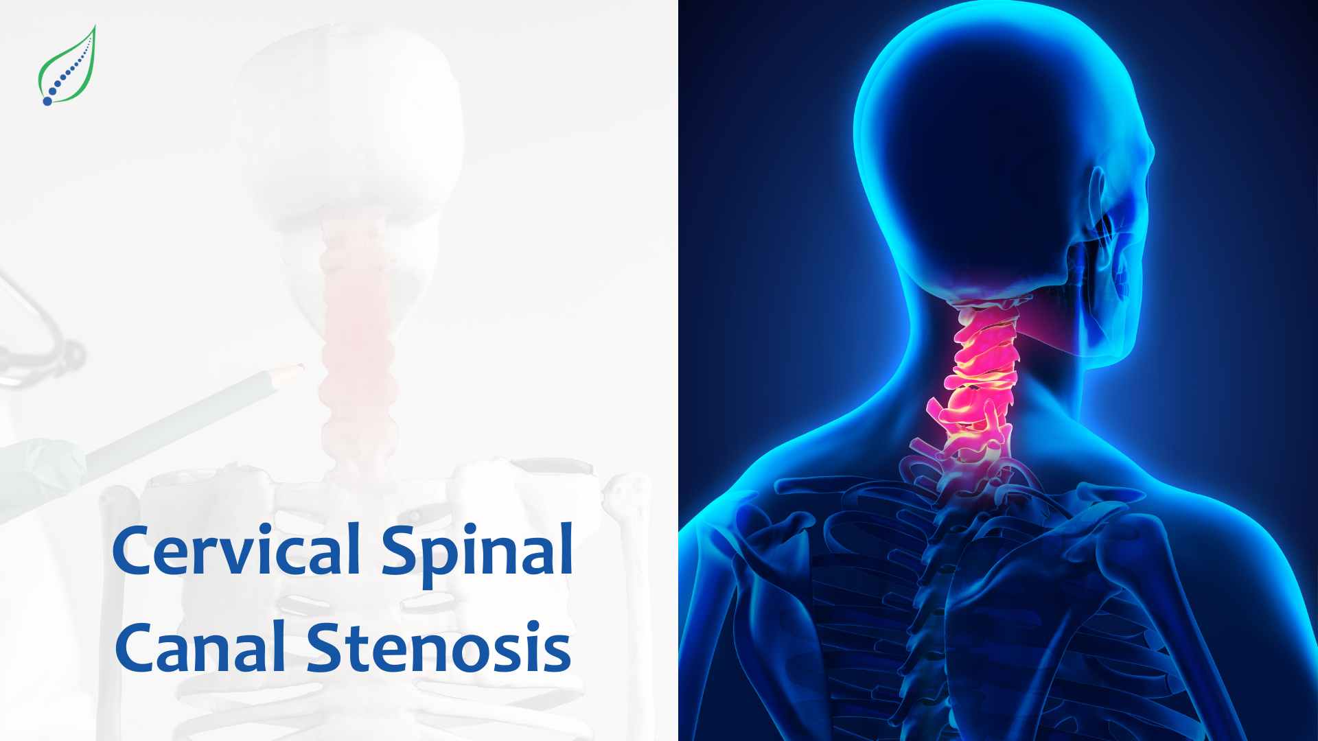 Cervical Spinal​ Canal Stenosis: Causes, Symptoms, and​ Nonsurgical Treatment Options